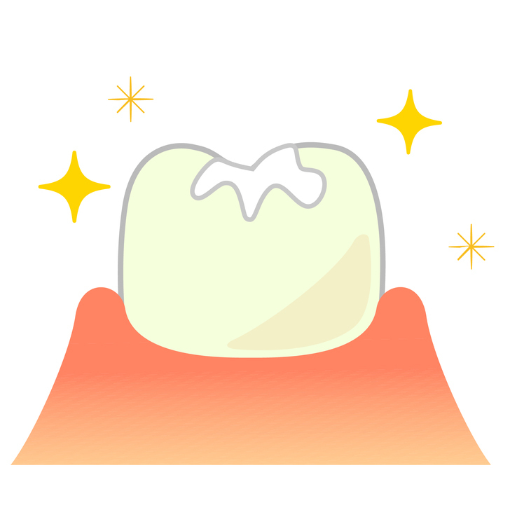 名古屋市名東区の虫歯治療