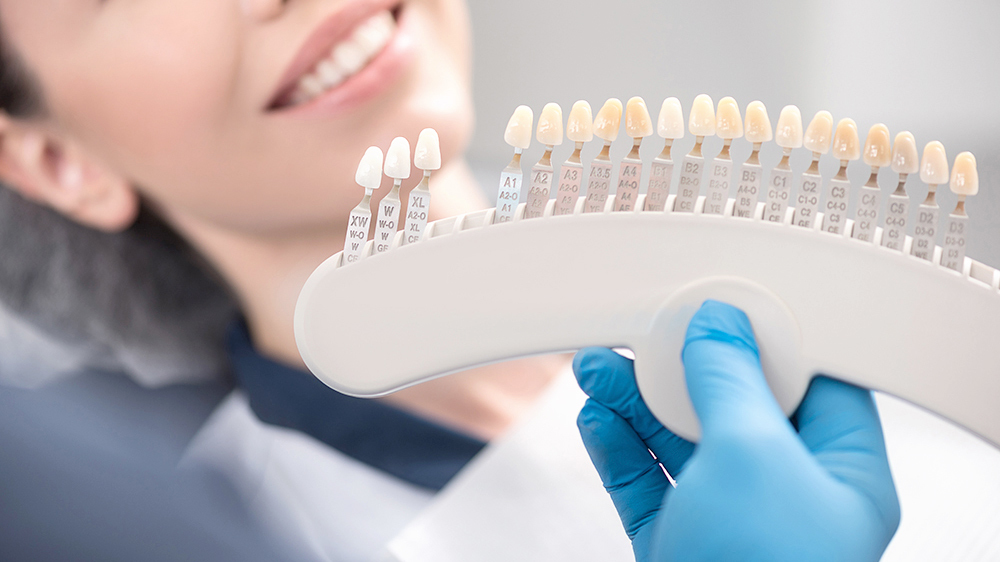 名古屋市名東区のホワイトニング