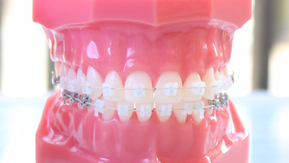 名古屋市名東区の矯正歯科