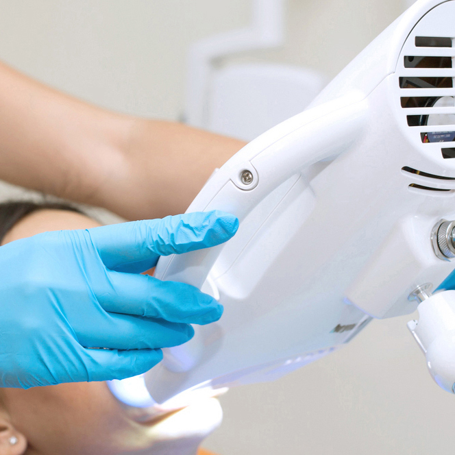 名古屋市名東区のホワイトニング