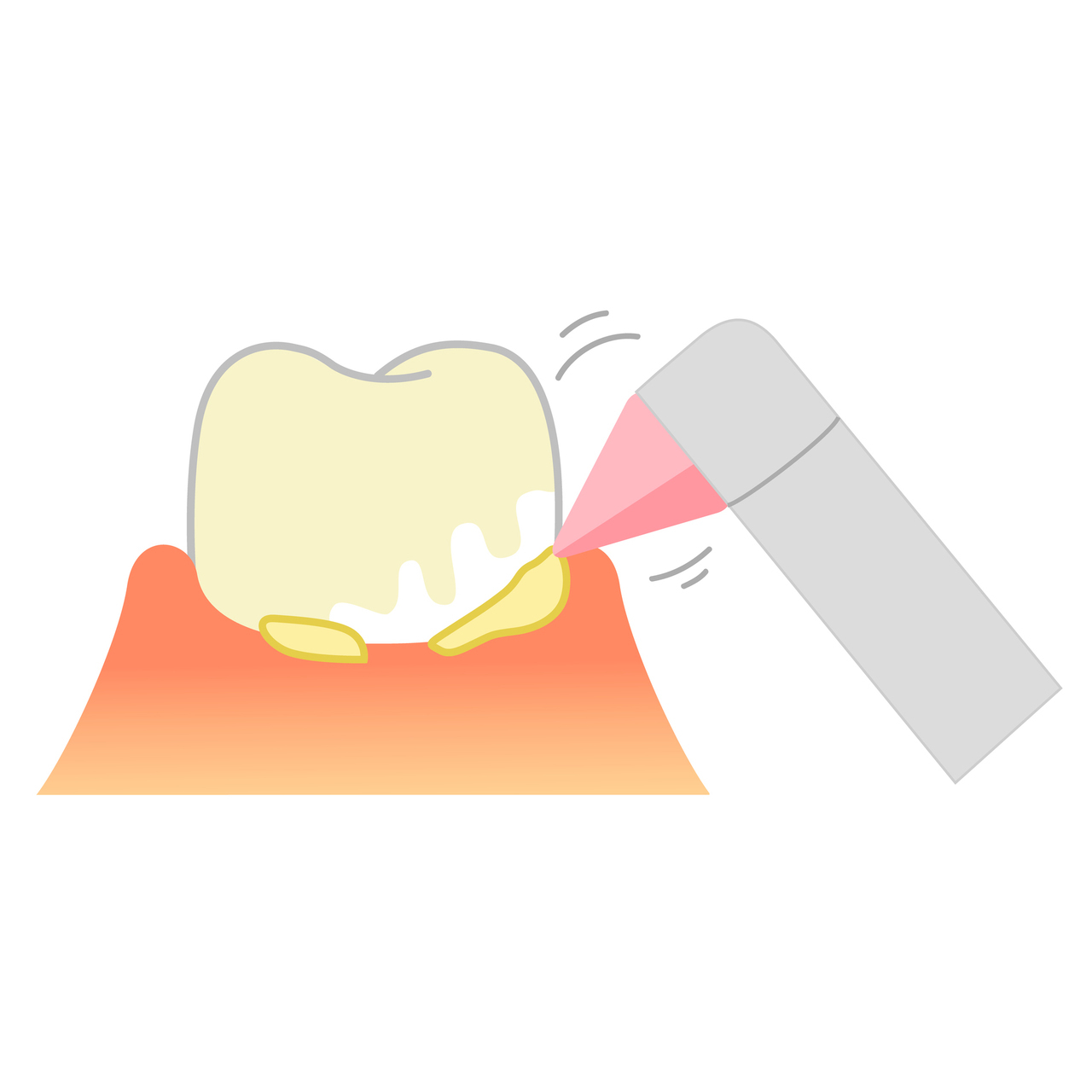 名古屋市名東区の予防歯科・定期検診