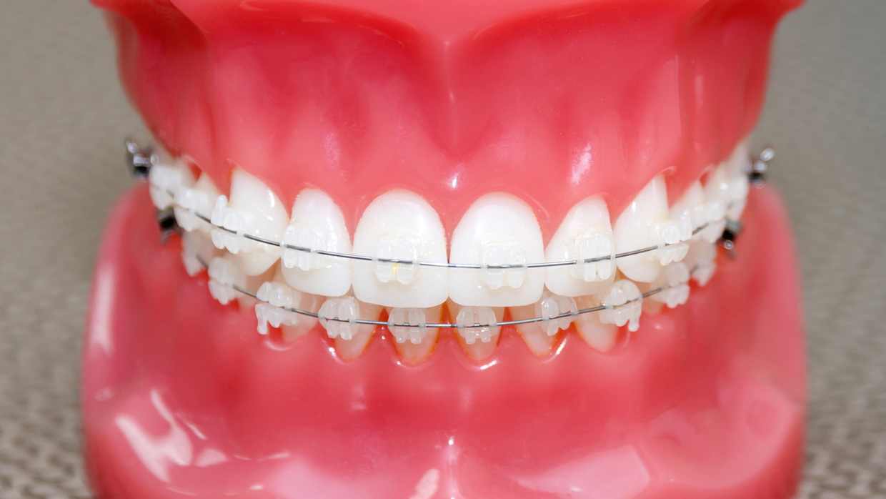 名古屋市名東区の矯正歯科